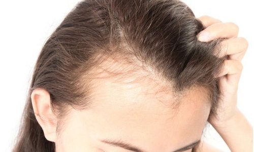 Espironolactona para os cabelos